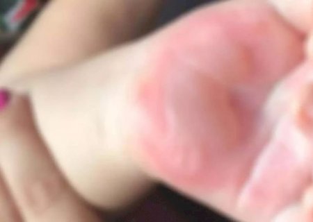 Mulher é levada à delegacia após queimar dedos da filha de 11 anos em fogão