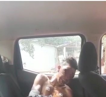 Com o rosto 'arrebentado' após agressões, jovem recebe alta no HV e depois precisa voltar à UTI