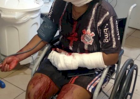 Mulher é ferida a golpes de facão e quase tem a mão decepada em aldeia
