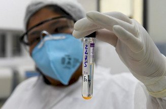 Lacen passará a fazer sequenciamento genômico da turberculose em MS