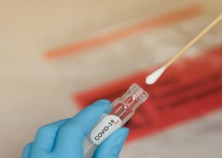 Boletim semanal registra mais 601 casos e 7 mortes por Covid-19 em MS