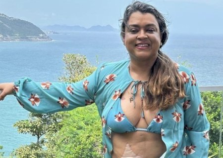 Preta Gil deixa a bolsa de ileostomia à mostra em novas fotos
