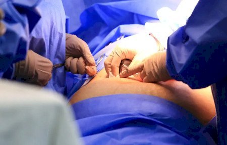 MS poderá zerar fila de cirurgias no SUS com novo programa de investimentos