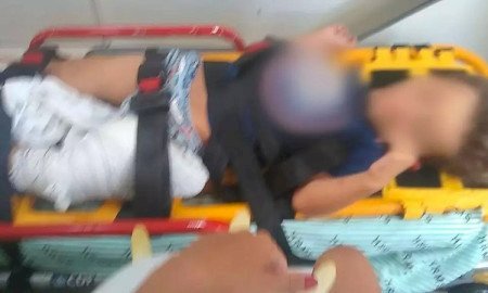 Justiça decreta prisão de pai que chutou e quebrou a perna do filho
