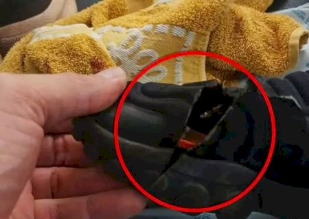 Menino de 5 anos tem pé esmagado ao ser atingido por peça em autódromo