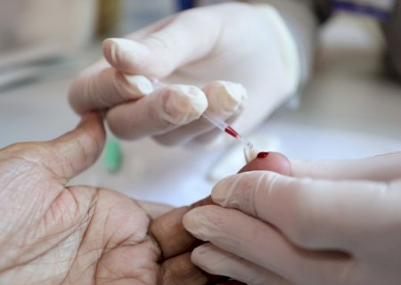Saúde reforça ações de prevenção e diagnóstico das hepatites virais