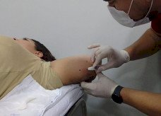 MS avança na qualificação e oferta de métodos contraceptivos de longa duração