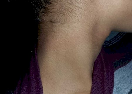 Adolescente de 16 anos sofre tentativa de estrangulamento e foge para escapar de namorado