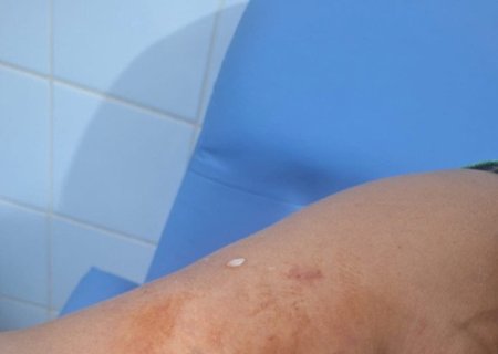 Mulher é ferida com faca e agressor preso por tentativa de feminicídio em Dourados