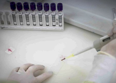 Exames descartam ebola em imigrante da República Democrática do Congo