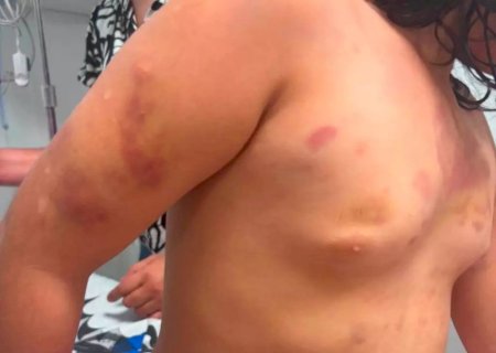 Mãe de menina espancada pelo padrasto na fronteira cobrou dinheiro para devolver a filha