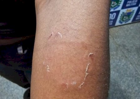 Após várias ligações, polícia prende homem que enforcou e mordeu mulher